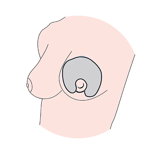 Cuscinetti Termici Per Il Seno - 1256 4 Cuscinetti Termici Per Il Seno - 1256 - immagine 4